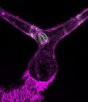 Inside a Plant Hair by Abu Habib Md Abdullah